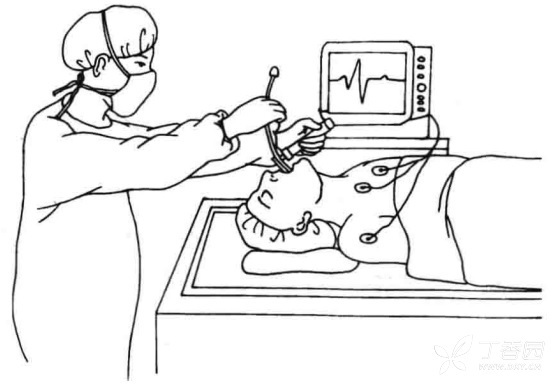 endotracheal tube process