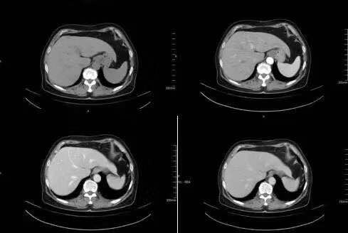 1 1