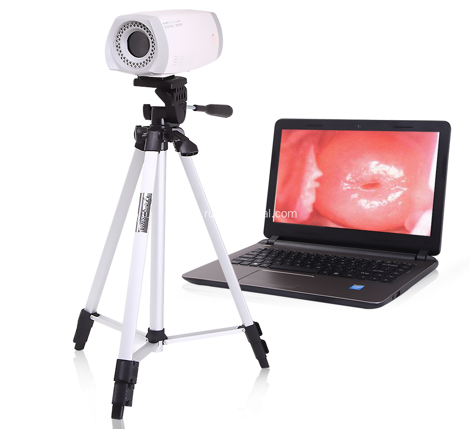 Medical Digital Portable Video Colposcope For Gynecology
