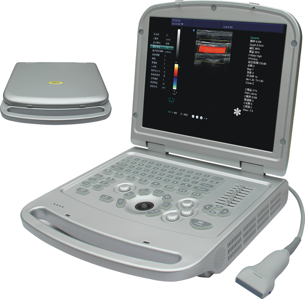 Machine à ultrasons pour ordinateur portable Color Doppler