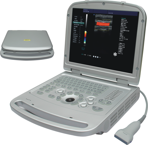 Full digital färg doppler ultraljudsscanner