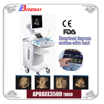 Touch Screen Doppler Ultrasound 3D/4D Color Doppler Ultrasound