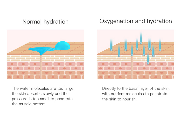 dermabrasion facial treatment