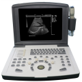 Portable Full Digital Diagnostic Ultrasound scanner