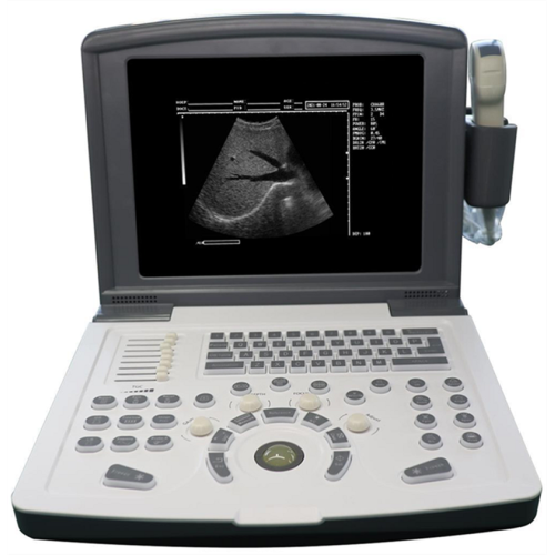 Portable Full Digital Diagnostic Ultrasound scanner