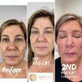 LIVRADO FACIAL FILI FISH PRSEE COG PDO