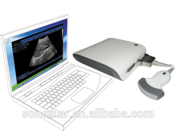 UBox-10 Ultrasound B Scanner Box(with 3D imaging,ultrasoni,black white,scanner)