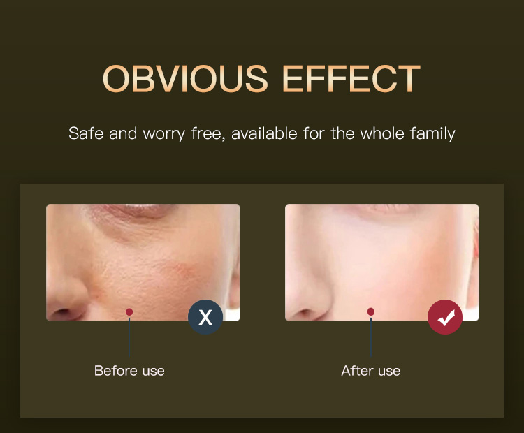 red light therapy for skin rejuvenation