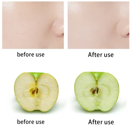 UV Clear Facial Sunscreen Broad-Spectrum SPF 18/SPF 50