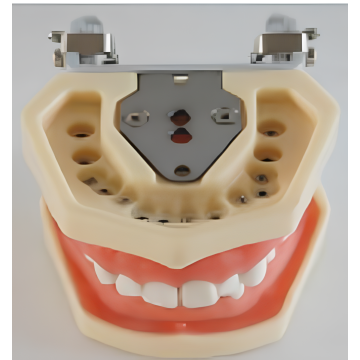 Model gigi standard dengan penetapan kacang
