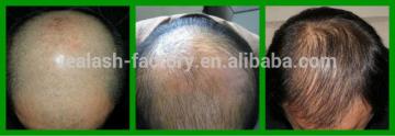 Hair growth spray, real plus.