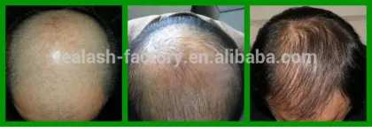 Hair growth spray, real plus.