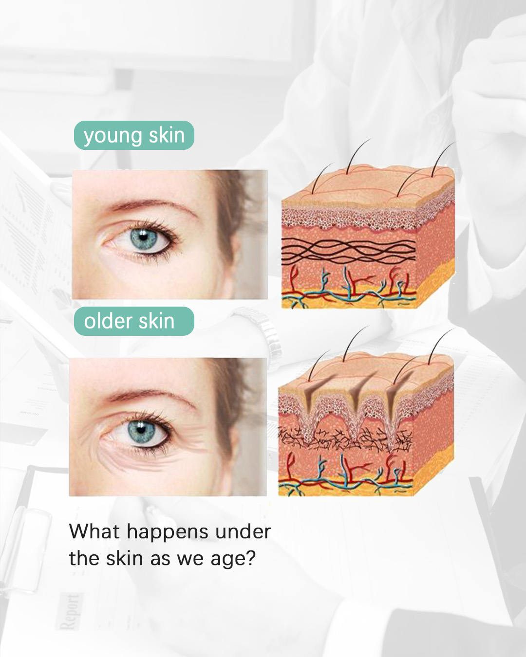How to Delay Skin Aging with Reborn PLLA