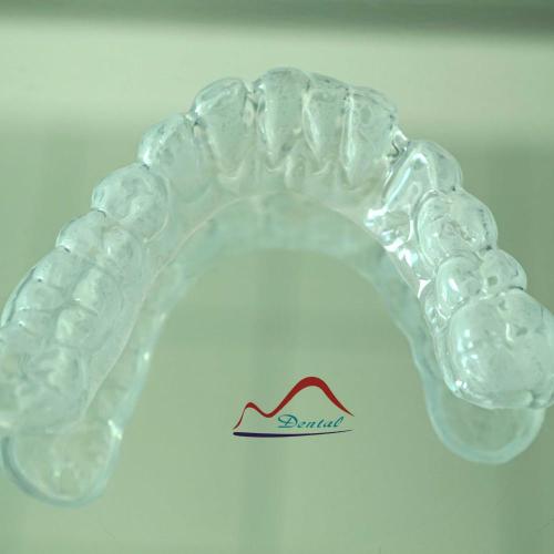 Dental Removable Bleaching Tray
