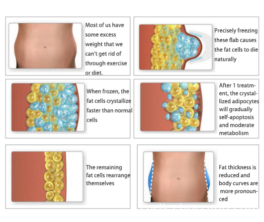 weight loss machine