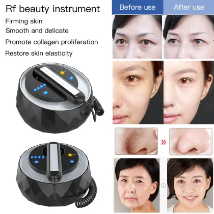 Professional RF Skin Tightening Machine for Face Lifting & Firming