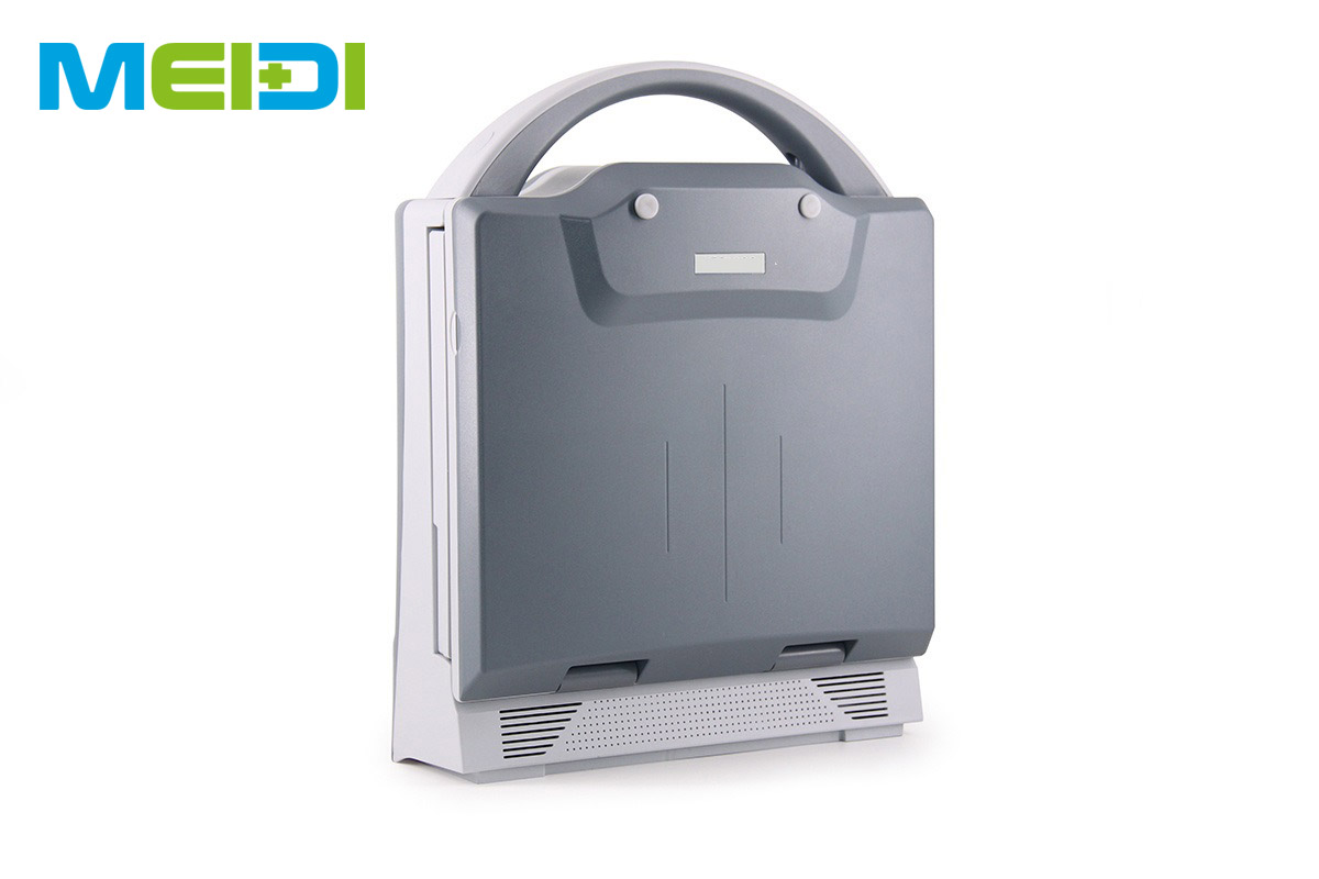 Full Digital B Mode Ultrasound Scanner