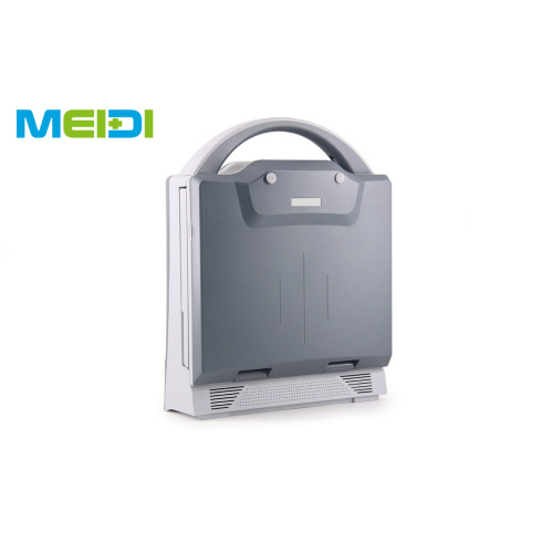 Full Digital B Mode Ultrasound Scanner