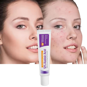 Wholesale 20g Azelaic Acid Serum for Acne and Skin Discoloration Repair