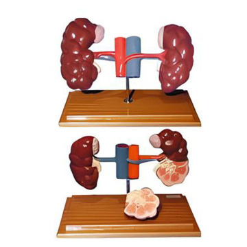 Modelo anatómico de riñón bovino