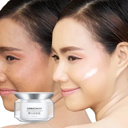 Brightening Whitening Cream for Freckle and Pigmentation Removal for Adults
