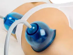 Vacuum Roller Breast Massager for Enlargement