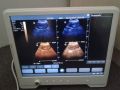 Draagbare Ultrasound Scanner Digitale echografie Machine Prijs