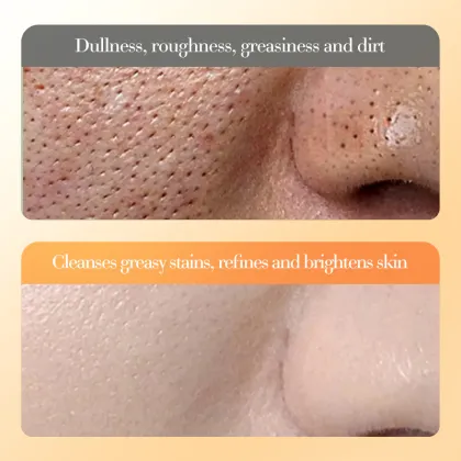 Vitamin E+B5 Facial Cleanser - Clean, Moisturize, Multi-effect