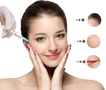 Hyaluronic एसिड सिरिंज इंजेक्शन शिकन fillers