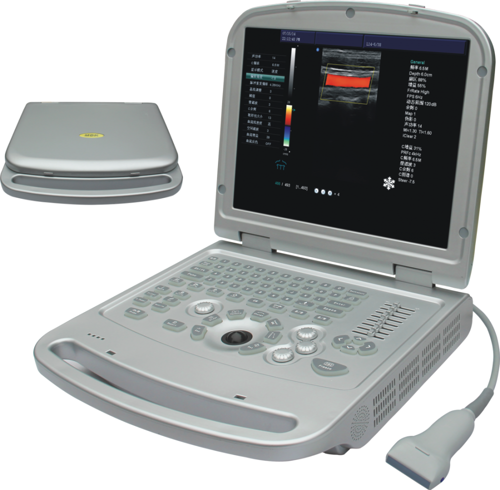 Laptop Ultraschallmaschinenfarbe Doppler Ultraschall