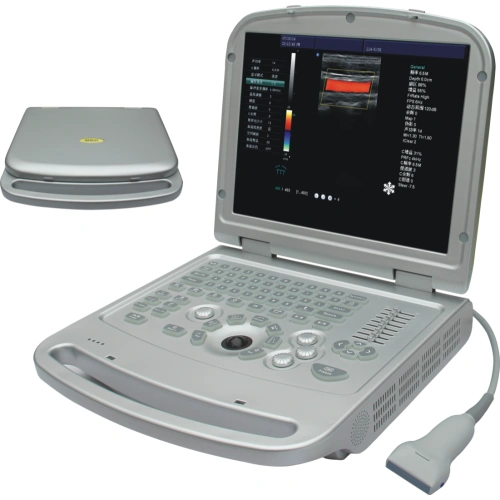 Doppler de couleur Portable, échographie humaine, gynécologie, appareil à  écho, vente