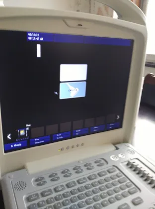 Portable sonoscape ultrasound echocardiography echo machine