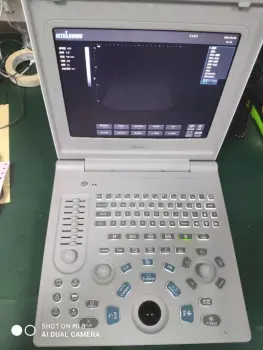 labtop ultrasound B&W portable