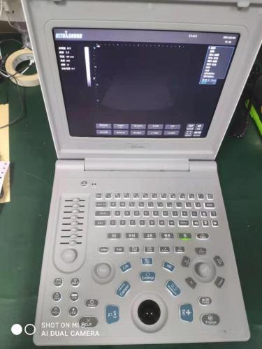 Laptop Ultrasound Diagnostic System SS-6B