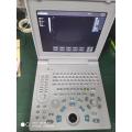 Laptop Ultrasound Diagnostic System SS-6B