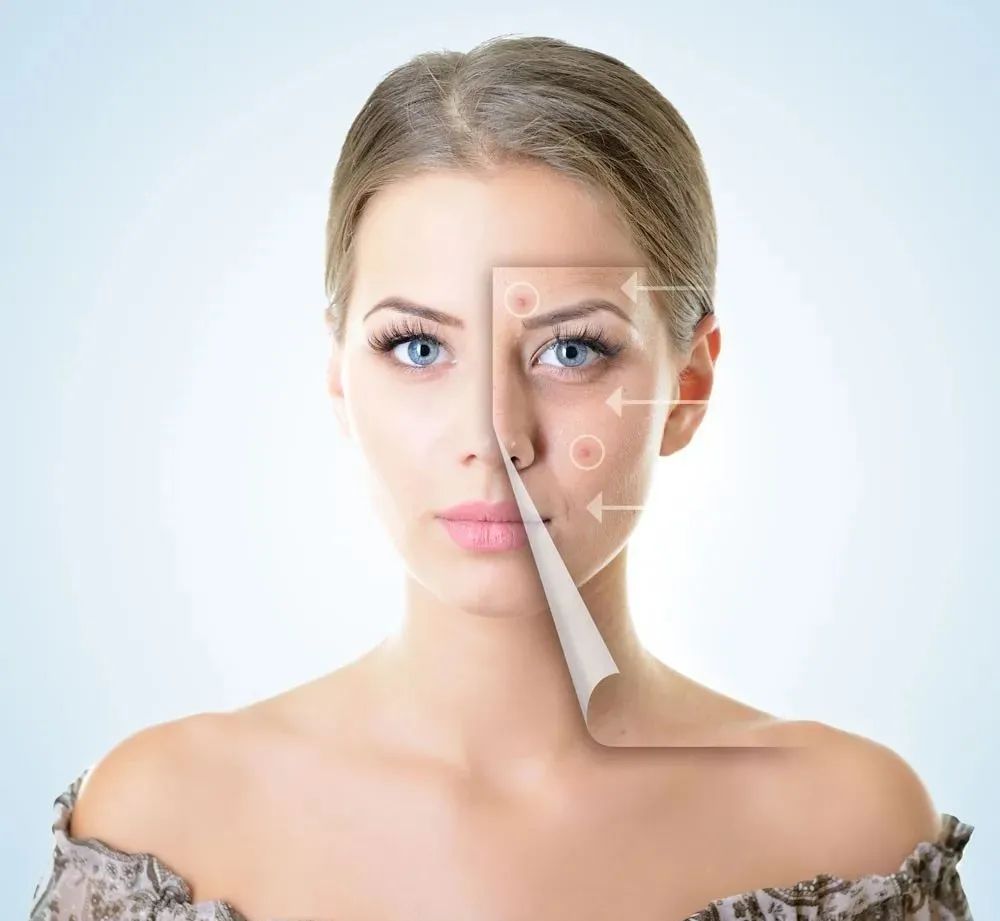 anti-aging
