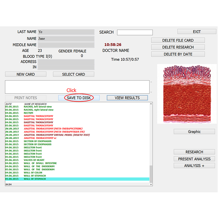 biofeedback bioresonance 8d nls therapy health analyzer