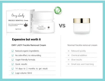 Omylady Organic Face Moisturizer - Freckle Fade Removal Cream