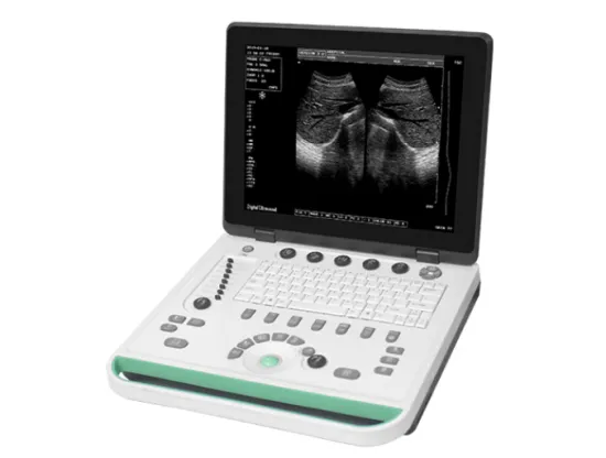 Laptop 15 inch screen ultrasound scanner
