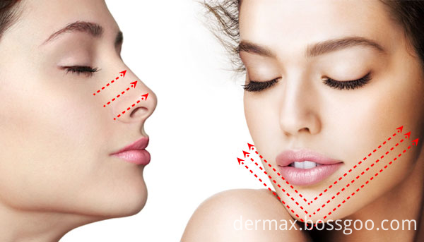 Magik Thread pdo face lifting