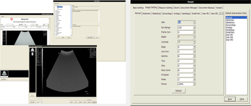 Laptop Full-Digital Ultrasound Scanner with 10.4