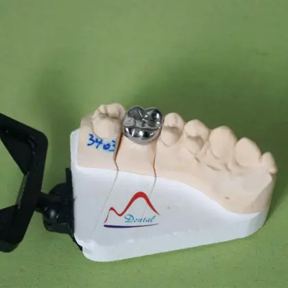 NP Full Metal Casting Crown