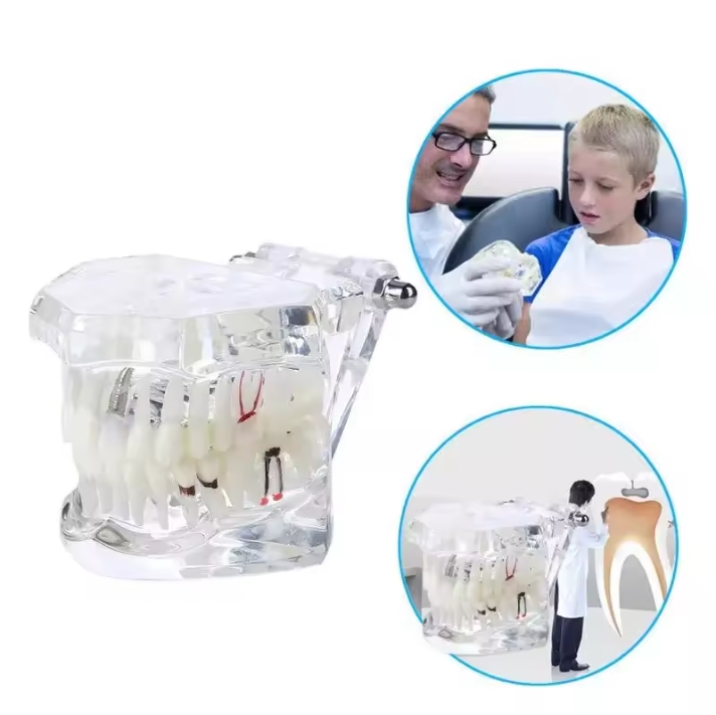 Teeth Model