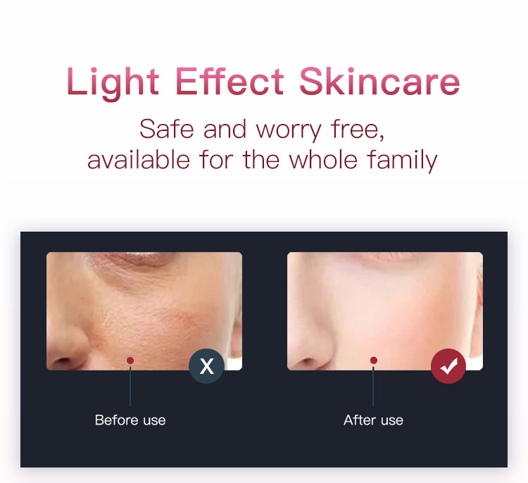 7 color LED beauty mask for face and neck