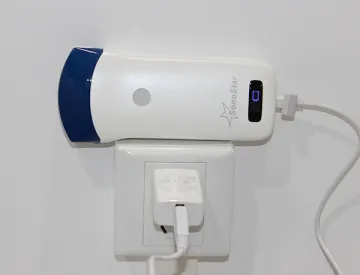 Portable Convex Mini Ultrasound Scanner
