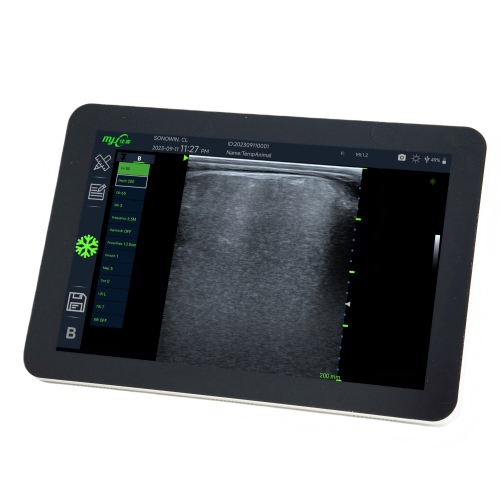 veterinary ultrasound machine price