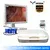 Medical Urology surgery equipment/ HD Urethro-cystoscopy endoscopy camera with led endoscope light source