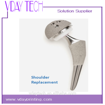 Qualified medical prosthetics implants built by 3d metal printers titanium alloy metallurgy