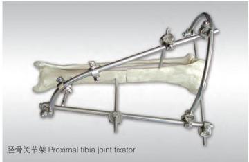 Orthopeidc Ilizarov External Bone Extended Pin Fixation