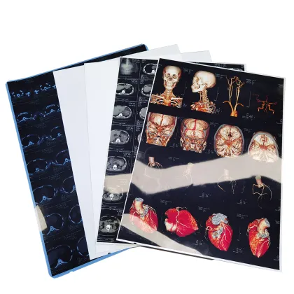 Inkjet Printing Medical Dry Laser X-ray Imaging Film